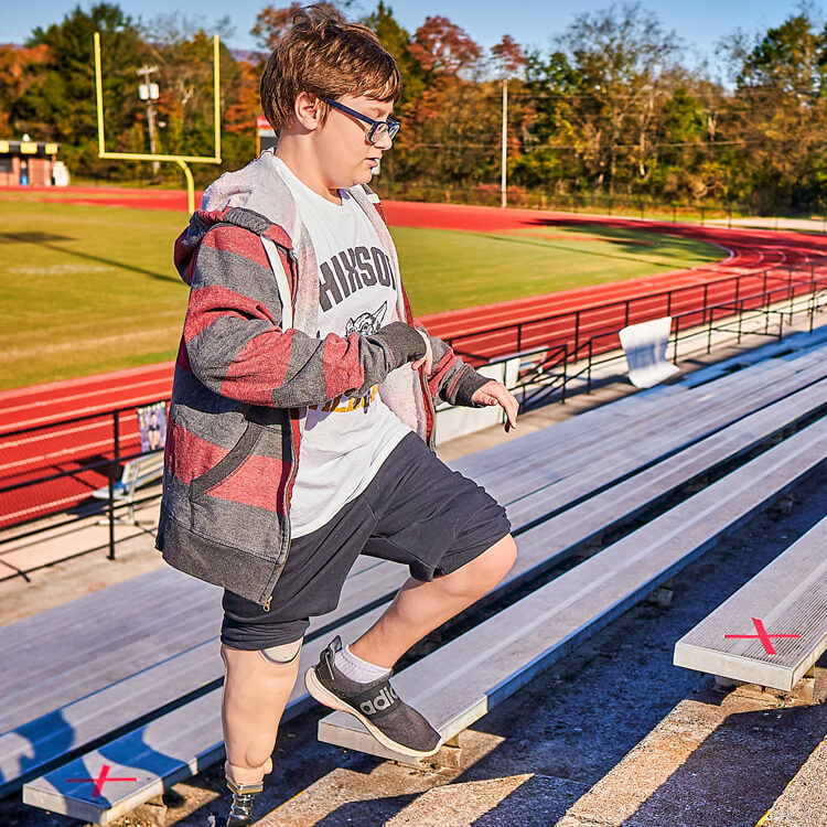 Young man walking up stairs with his custom prosthetic leg