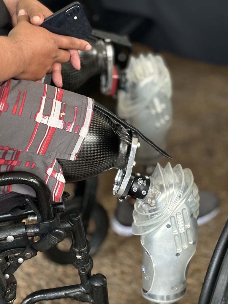 Advance Technology in Orthotics & Prosthetics